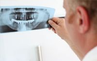 Supra o mesoestructura dental